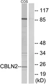 Anti-CBLN2 antibody used in Western Blot (WB). GTX87797