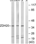 Anti-ZDHHC20 antibody used in Western Blot (WB). GTX87798