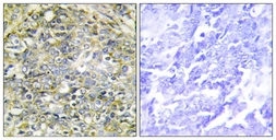 Anti-UBXD5 antibody used in IHC (Paraffin sections) (IHC-P). GTX87807