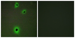 Anti-CADM4 antibody used in Immunocytochemistry/ Immunofluorescence (ICC/IF). GTX87808