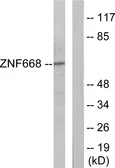 Anti-ZNF668 antibody used in Western Blot (WB). GTX87809