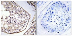 Anti-BAGE3 antibody used in IHC (Paraffin sections) (IHC-P). GTX87811