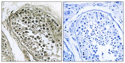 Anti-GAB4 antibody used in IHC (Paraffin sections) (IHC-P). GTX87813