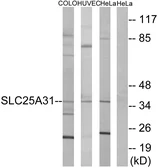 Anti-SLC25A31 antibody used in Western Blot (WB). GTX87816