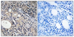 Anti-RPL17 antibody used in IHC (Paraffin sections) (IHC-P). GTX87817