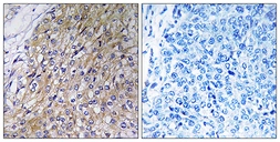 Anti-GOLT1A antibody used in IHC (Paraffin sections) (IHC-P). GTX87821