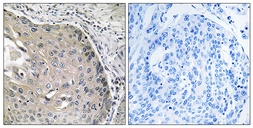 Anti-AOX1 antibody used in IHC (Paraffin sections) (IHC-P). GTX87822