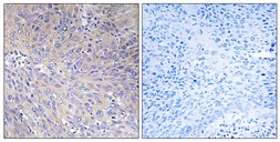 Anti-MRPL11 antibody used in IHC (Paraffin sections) (IHC-P). GTX87823