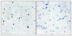 Anti-DCLK3 antibody used in IHC (Paraffin sections) (IHC-P). GTX87832