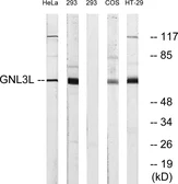 Anti-GNL3L antibody used in Western Blot (WB). GTX87842