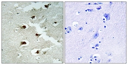 Anti-CDCA4 antibody used in IHC (Paraffin sections) (IHC-P). GTX87853