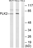 Anti-PLK2 antibody used in Western Blot (WB). GTX87865
