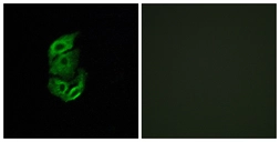 Anti-STA13 antibody used in Immunocytochemistry/ Immunofluorescence (ICC/IF). GTX87867