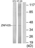 Anti-ZNF435 antibody used in Western Blot (WB). GTX87871