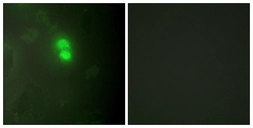 Anti-DKC1 antibody used in Immunocytochemistry/ Immunofluorescence (ICC/IF). GTX87872