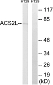 Anti-ACSS1 antibody used in Western Blot (WB). GTX87873