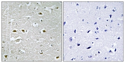 Anti-URB1 antibody used in IHC (Paraffin sections) (IHC-P). GTX87874