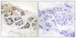 Anti-Mammaglobin A antibody used in IHC (Paraffin sections) (IHC-P). GTX87883