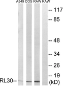Anti-RPL30 antibody used in Western Blot (WB). GTX87885
