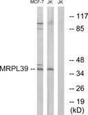 Anti-MRPL39 antibody used in Western Blot (WB). GTX87886
