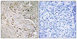 Anti-POTE8 antibody used in IHC (Paraffin sections) (IHC-P). GTX87888
