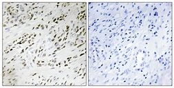 Anti-TSHZ2 antibody used in IHC (Paraffin sections) (IHC-P). GTX87889