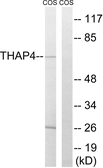 Anti-THAP4 antibody used in Western Blot (WB). GTX87897