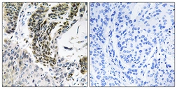 Anti-RREB1 antibody used in IHC (Paraffin sections) (IHC-P). GTX87900
