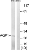 Anti-Aquaporin 1 antibody used in Western Blot (WB). GTX87904