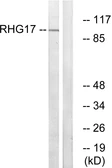 Anti-ARHGAP17 antibody used in Western Blot (WB). GTX87907