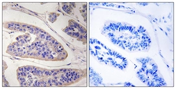Anti-Mena antibody used in IHC (Paraffin sections) (IHC-P). GTX87912