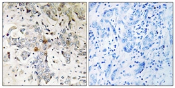 Anti-ZCCHC17 antibody used in IHC (Paraffin sections) (IHC-P). GTX87913