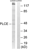 Anti-AGPAT5 antibody used in Western Blot (WB). GTX87914