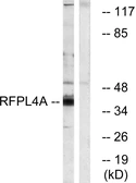 Anti-RFPL4A antibody used in Western Blot (WB). GTX87916