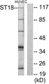 Anti-ST18 antibody used in Western Blot (WB). GTX87918