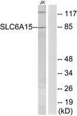 Anti-SLC6A15 antibody used in Western Blot (WB). GTX87925