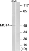 Anti-MCT4 antibody used in Western Blot (WB). GTX87926