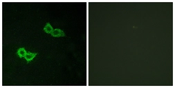 Anti-GPR150 antibody used in Immunocytochemistry/ Immunofluorescence (ICC/IF). GTX87932