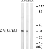 Anti-OR1S1 + OR1S2 antibody used in Western Blot (WB). GTX87935