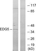 Anti-EDG5 antibody used in Western Blot (WB). GTX87937