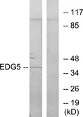 Anti-EDG5 antibody used in Western Blot (WB). GTX87937