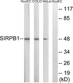 Anti-SIRP beta 1 antibody used in Western Blot (WB). GTX87943