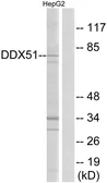 Anti-DDX51 antibody used in Western Blot (WB). GTX87946