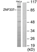 Anti-ZNF337 antibody used in Western Blot (WB). GTX87955