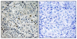 Anti-USP53 antibody used in IHC (Paraffin sections) (IHC-P). GTX87956
