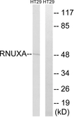 Anti-PHAX antibody used in Western Blot (WB). GTX87958