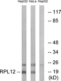 Anti-RPL12 antibody used in Western Blot (WB). GTX87963
