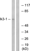 Anti-CABLES1 antibody used in Western Blot (WB). GTX87964