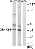 Anti-OR4K14 antibody used in Western Blot (WB). GTX87987