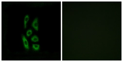 Anti-ACOT12 antibody used in Immunocytochemistry/ Immunofluorescence (ICC/IF). GTX87992